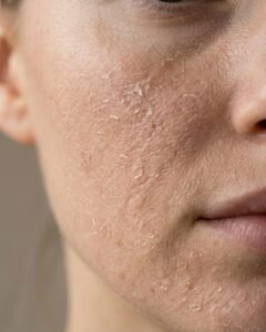 dry, lifeless skin? overnight routine for glowing, hydrated skin